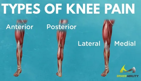Knee pain location Chart: expertise the discomfort